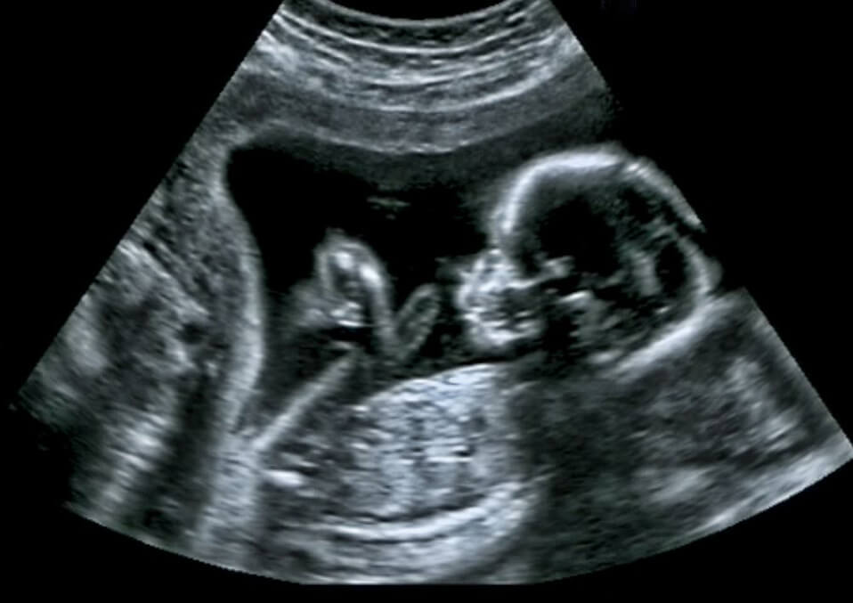 You are currently viewing Ultrasound Scan – Tagum City