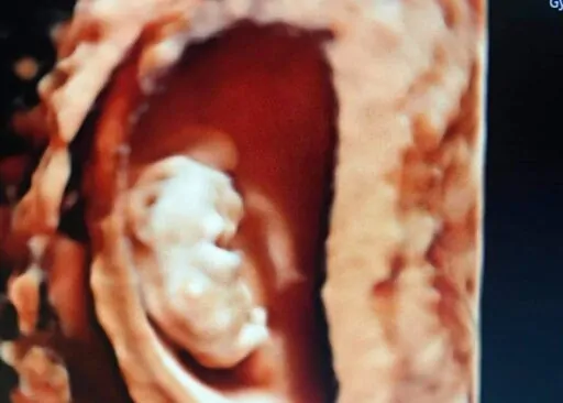 Clinica Mendoza Medical & Ob-Gyne Ultrasound Clinic – Tagum City