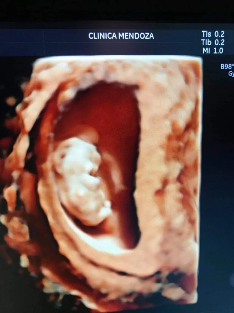 Clinica Mendoza Medical & Ob-Gyne Ultrasound Clinic – Tagum City