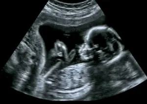 Ultrasound Scan – Tagum City